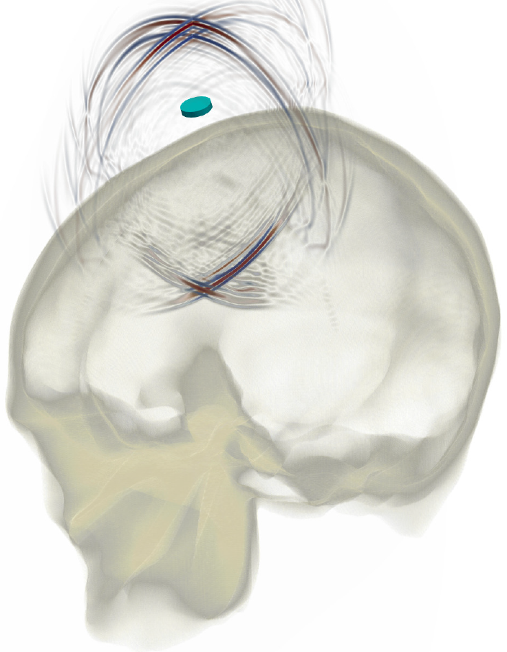 Enlarged view: skull wavefield